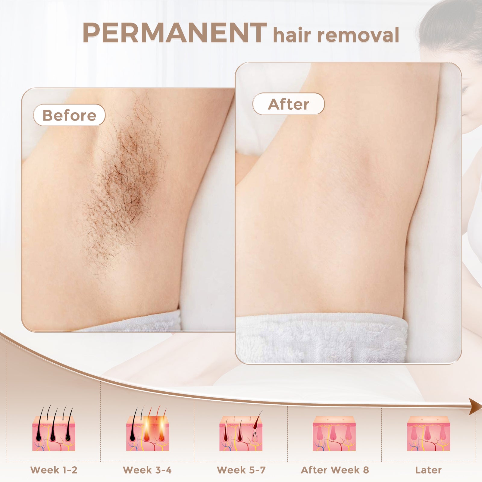 LVARA IPL Hair Removal Permanent Laser Hair Removal Device for Women M